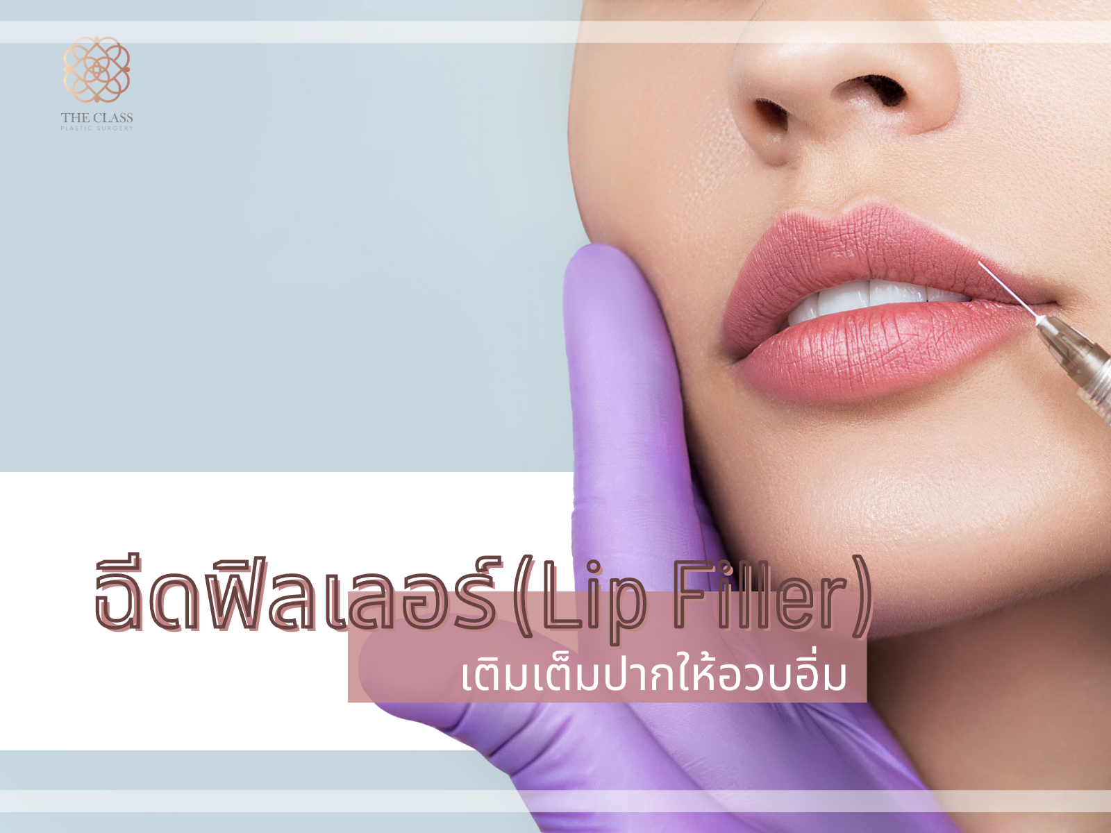 Lip Filler by หมอเติ๊ด003